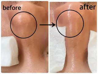 韓国肌管理 【毛穴専科】のエステ・リラクイメージ