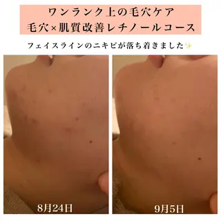 Bellesthe (ベルエステ)のエステ・リラクイメージ