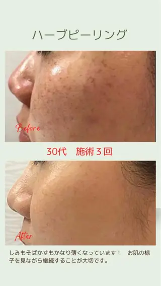 ベラージュ【美背中・ 美尻・フェイシャル】のエステ・リラクイメージ