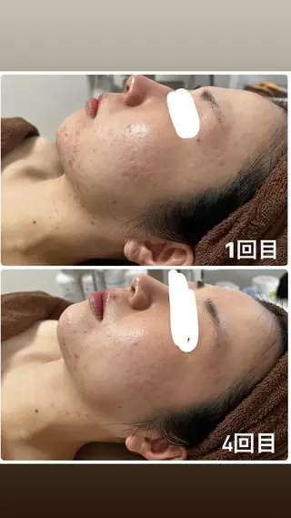 心斎橋痩身ダイエット 韓国.美容鍼.小顔のエステ・リラクイメージ