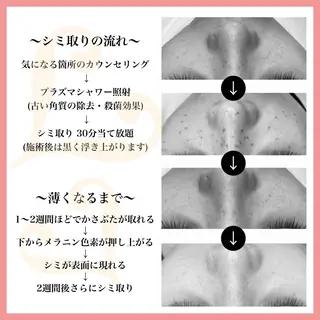 脱毛&フェイシャル 専門店muro.のエステ・リラクイメージ