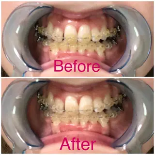 イーチブライト EachBrightのその他イメージ