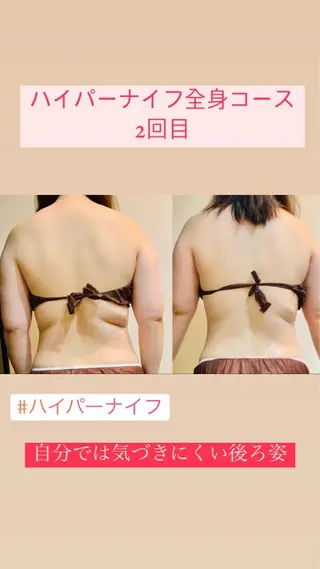 Einami 美肌痩身サロンのエステ・リラクイメージ