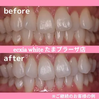 セルフホワイトニング　エクシアたまプラーザ店所属・セルフホワイトニング エクシアたまプラーザのその他イメージ