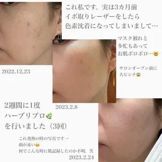 1ヶ月後も半分残る 高持続LEDエクステのマツエク・マツパデザイン