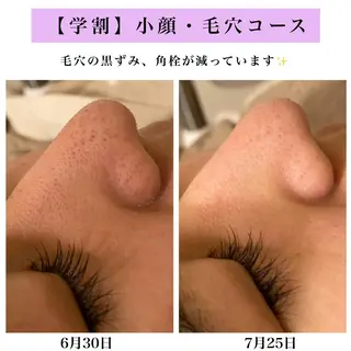 Bellesthe (ベルエステ)のエステ・リラクイメージ