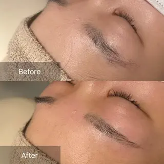 アイブロウ for woman所属・森 美優のエステ・リラクイメージ