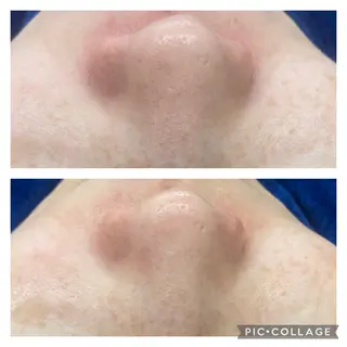 RE:moom リムーム/脱毛エステのエステ・リラクイメージ