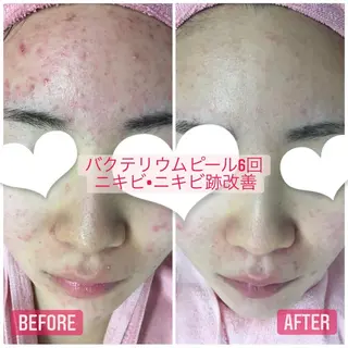 透明感の肌Lino malieのエステ・リラクイメージ