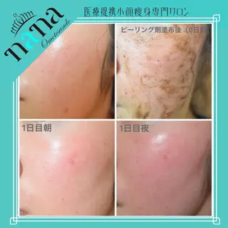 小顔痩身インディバ Nana表参道のエステ・リラクイメージ