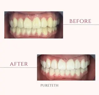 ホワイトニングサロンPURETETH所属・ホワイトニングサロン PURETETHのエステ・リラクイメージ