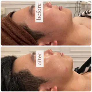 立体小顔×艶肌×美ボ ディ似合わせ施術 岡のエステ・リラクイメージ