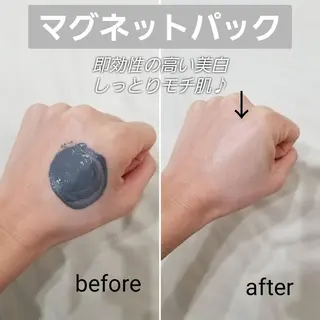 Anacia Beauty Salon所属・美肌脱毛&毛穴専門 Anaciaのエステ・リラクイメージ