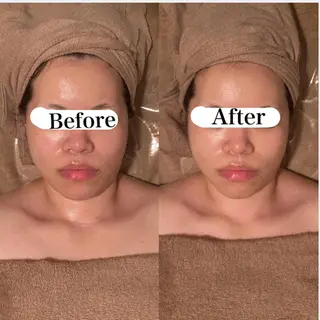 B&H所属・頭痛•肩こり専門/ 眉サロンB&H心斎橋のエステ・リラクイメージ