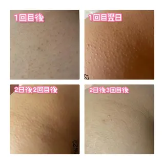 【足圧】鬼👹リンパ 身体整うサロンのエステ・リラクイメージ