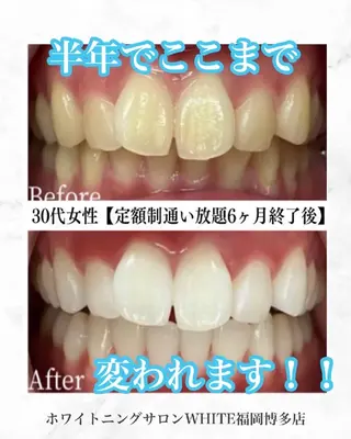 キッズ メンズ ホワイトニングサロン WHITE福岡博多店のエステ・リラクイメージ