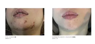 Serapia 【セラピア】のマツエク・マツパデザイン