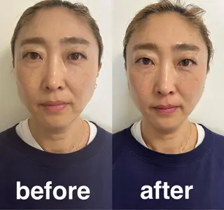 美容鍼灸サロン mahoroba院長のエステ・リラクイメージ