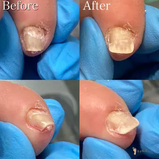 ネイル 東京巻き爪アカデミー所属・東京巻き爪 アカデミーのエステ・リラクイメージ