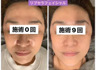 Private Salon Prunelle所属・プライベートサロン プリュネルのエステ・リラクイメージ