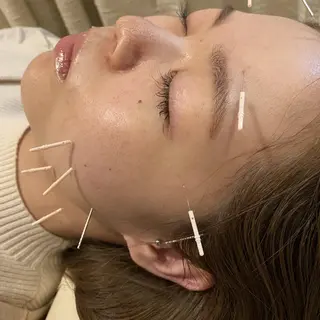 むくみたるみ専門☆ 美容鍼・小顔矯正のエステ・リラクイメージ
