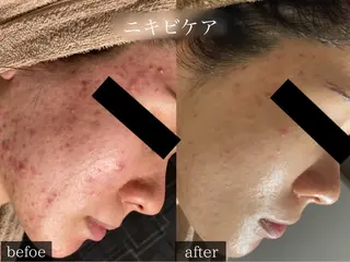 rejena 山口のエステ・リラクイメージ