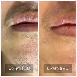 メンズ エマニエル USAのエステ・リラクイメージ