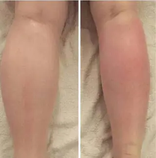 ☺ハーブピール💕 ソフィアカロン💖のエステ・リラクイメージ