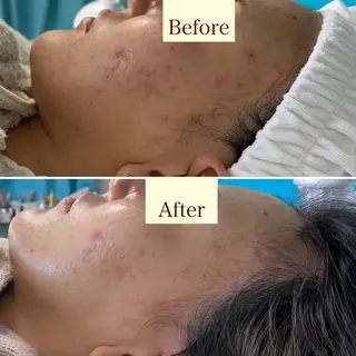 メンズ歓迎🙆‍♀️ エステ/ネイルISTのエステ・リラクイメージ