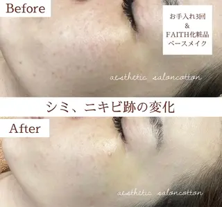 都度払い 肌質改善専門サロンのエステ・リラクイメージ