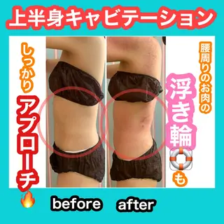 痩身/脱毛/ネイル HARUKAのエステ・リラクイメージ