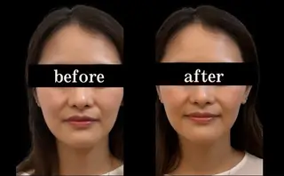 小顔/たるみ/黒ずみ除去専門サロン/SONA 大和西大寺店所属・【小顔専門看護師 サロンSONA】のエステ・リラクイメージ