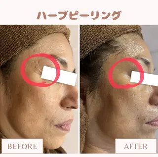 メンズ キッズ Amaryllis 🌹松本のエステ・リラクイメージ