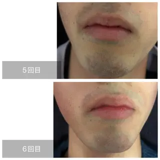 メンズ アイブロウ エマニエル USAのエステ・リラクイメージ