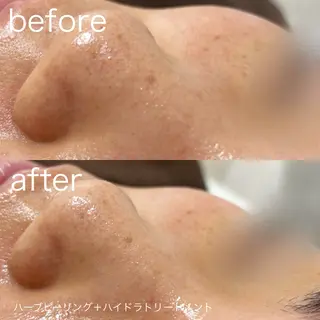 lulularico Yuのエステ・リラクイメージ