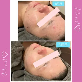 Monart -deux-のエステ・リラクイメージ