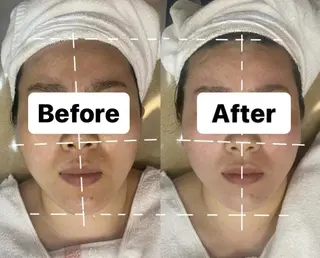 OPREA 千種店のエステ・リラクイメージ