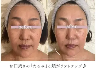 頭蓋骨小顔コルギPerm所属・頭蓋骨小顔コルギ Permのその他イメージ