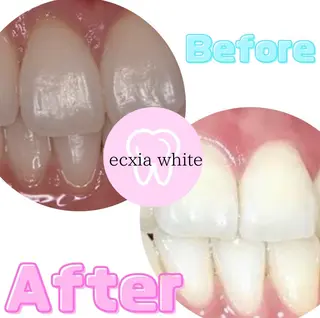 ecxia  white 　広島袋町店所属・セルフホワイトニング エクシア広島袋町店のその他イメージ