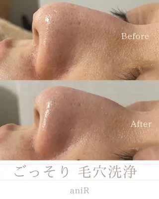 北浜/毛穴・ツヤ肌 サロンaniRのエステ・リラクイメージ