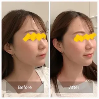 新宿hari-me所属・美容鍼hari-me 新宿のエステ・リラクイメージ