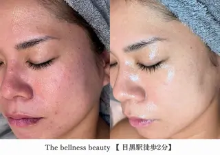 《毛穴レス美肌》ザ・ ベルネス 目黒駅2分のエステ・リラクイメージ