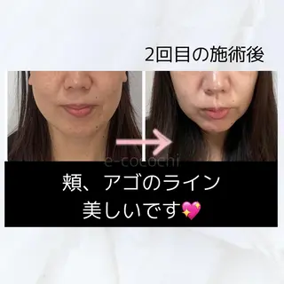 小顔と ヘッドスパのお店のエステ・リラクイメージ