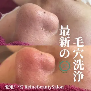 Reine BeautySalon所属・毛穴/シミ肝斑/脱毛 横山梨里のエステ・リラクイメージ