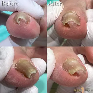 東京巻き爪アカデミー所属・東京巻き爪 アカデミーのエステ・リラクイメージ