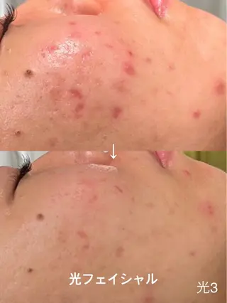 【LEPUS】 nishimoriのエステ・リラクイメージ