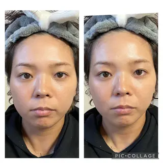 筋膜フェイシャル UruSALON🌿のエステ・リラクイメージ