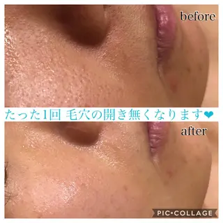 ミディアム カラー パーマ ヘアアレンジ キッズ ネイル マツエク・マツパ Ensor Clair所属・EnsorClair 代表 野口真央のエステ・リラクイメージ