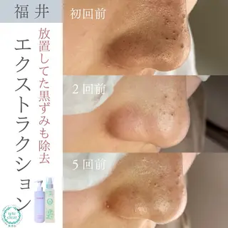 毛穴ケア専門サロン Yourmeユアミーのエステ・リラクイメージ