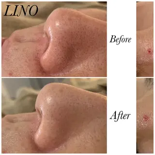 beautysalon  LINO所属・平日限定！お得！ 全メニュ¥5,500のエステ・リラクイメージ